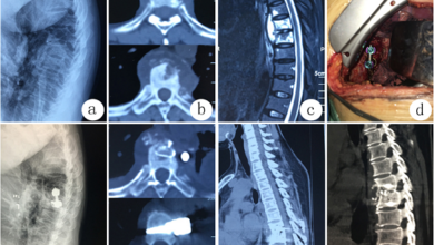 Spine Surgeon in Kerala