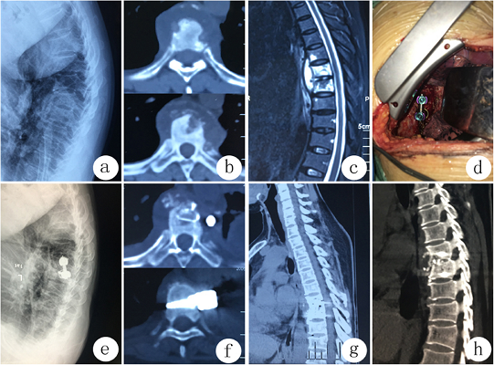 Spine Surgeon in Kerala