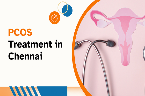 Pcos Treatment in Chennai