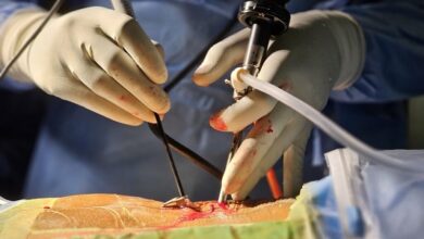 Endoscopic Spine Surgery in Kerala