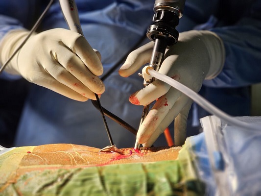 Endoscopic Spine Surgery in Kerala