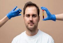 Hair Treatment in Kolkata