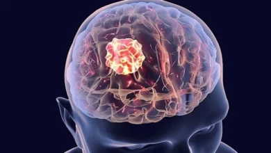 Brain Cancer Treatment in India