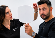 Chicago hair transplant expert
