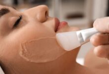Chemical Peeling in Kolkata