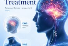 Epilepsy Surgery in India