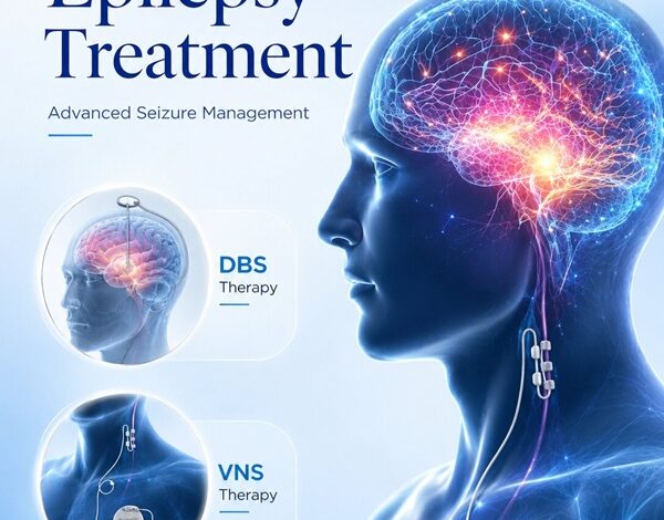 Epilepsy Surgery in India