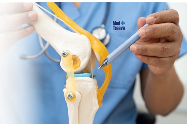 Knee Transplant Surgery in India