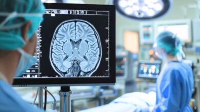 Best Neurosurgeon in Guwahati