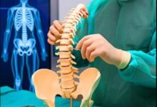 Cervical Disc Replacement Kerala