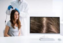 Exosomes Treatment​