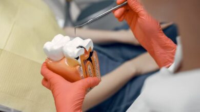 Painless Root Canal in Kondapur