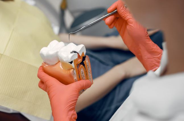 Painless Root Canal in Kondapur
